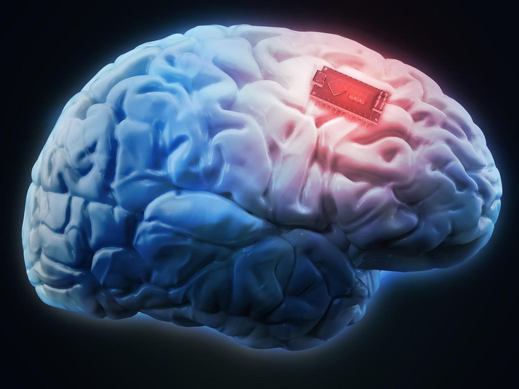 Human brain implant